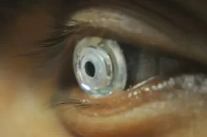 Crean lentes de contacto que funcionan como telescopios
