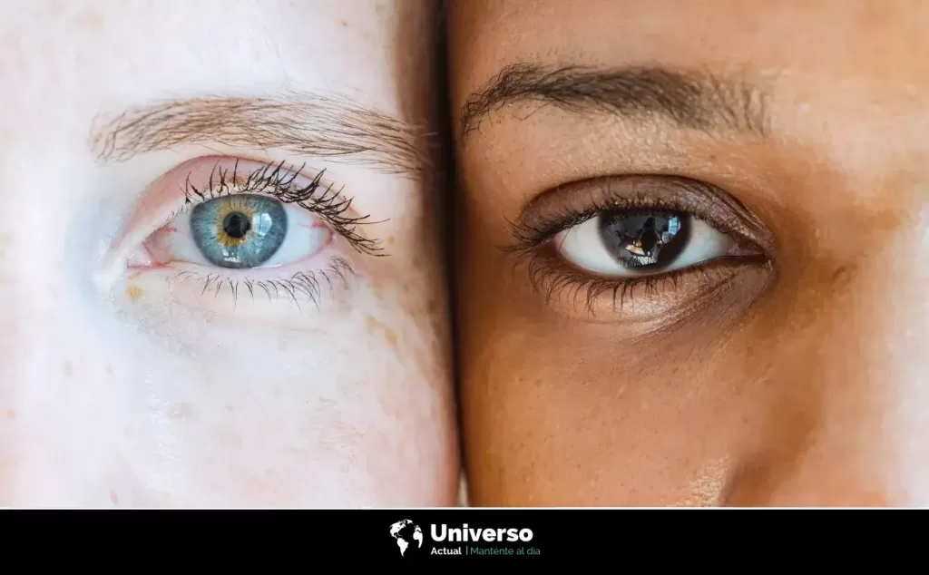 El impactante efecto de los derrames en el ojo por estrés