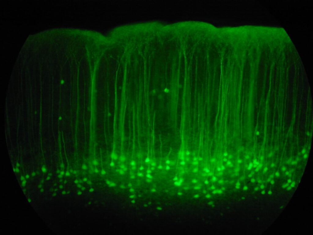Neuronas de colores brillantes conectadas entre sí vistas al microscopio